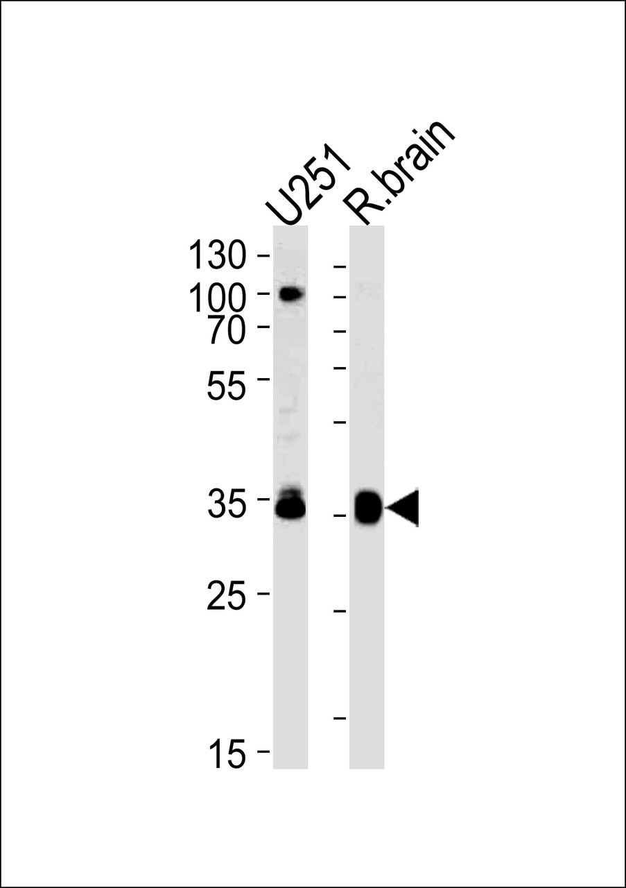 Western blot analysis in U251 cell line and rat brain lysates (35ug/lane) .