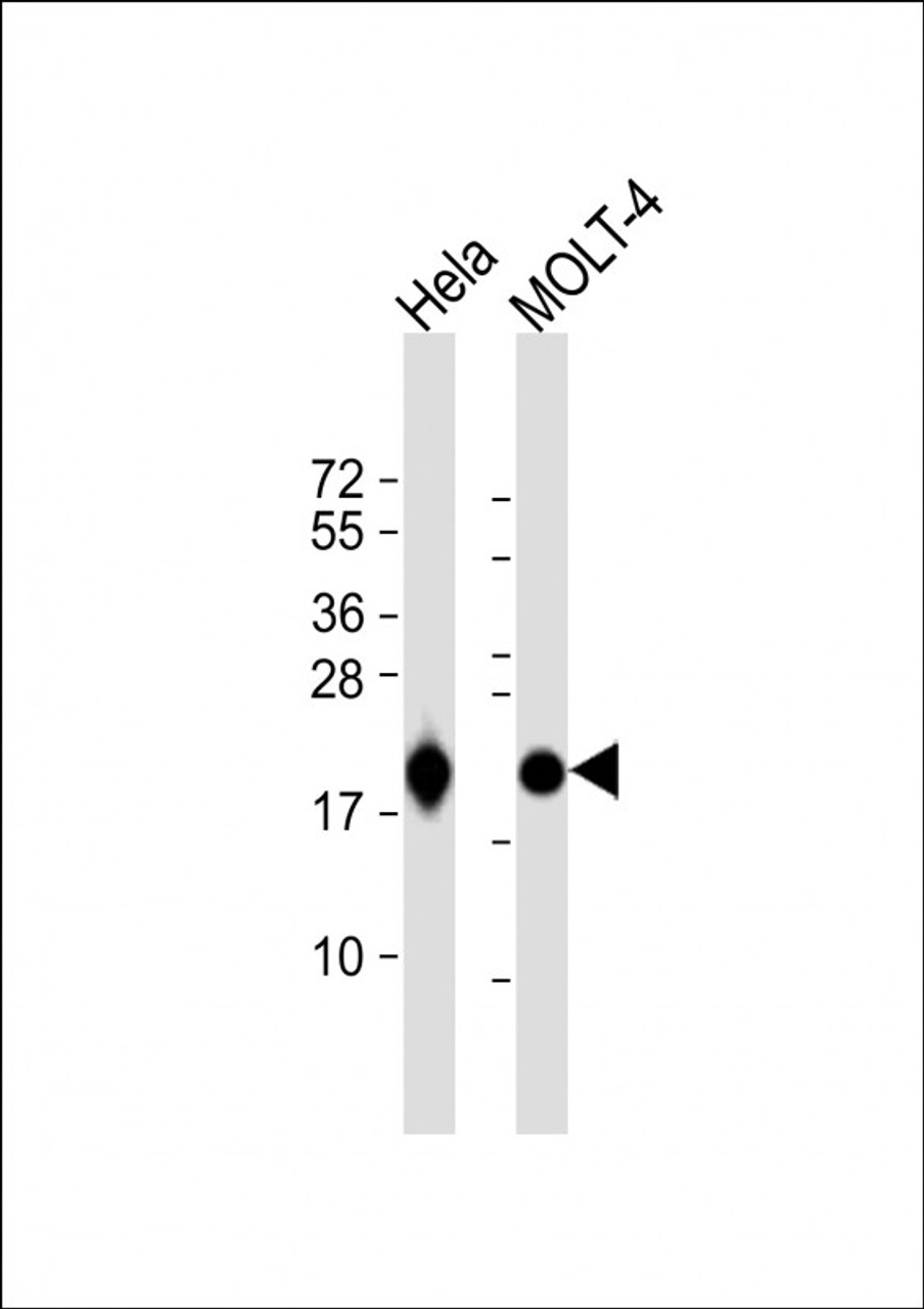 Western Blot at 1:1000 dilution Lane 1: Hela whole cell lysate Lane 2: MOLT-4 whole cell lysate Lysates/proteins at 20 ug per lane.