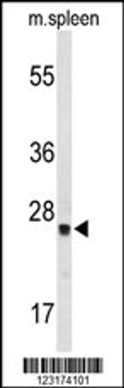 Western blot analysis of TPK1 Antibody in mouse spleen tissue lysates (35ug/lane)