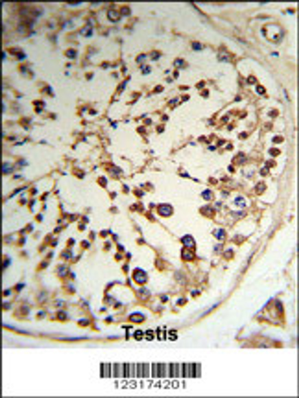 Formalin-fixed and paraffin-embedded human testis tissue reacted with TPK1 Antibody (N-term) , which was peroxidase-conjugated to the secondary antibody, followed by DAB staining.