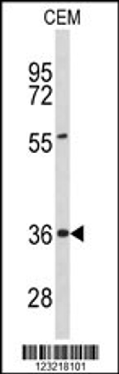 Western blot analysis of PEX16 Antibody in CEM cell line lysates (35ug/lane)