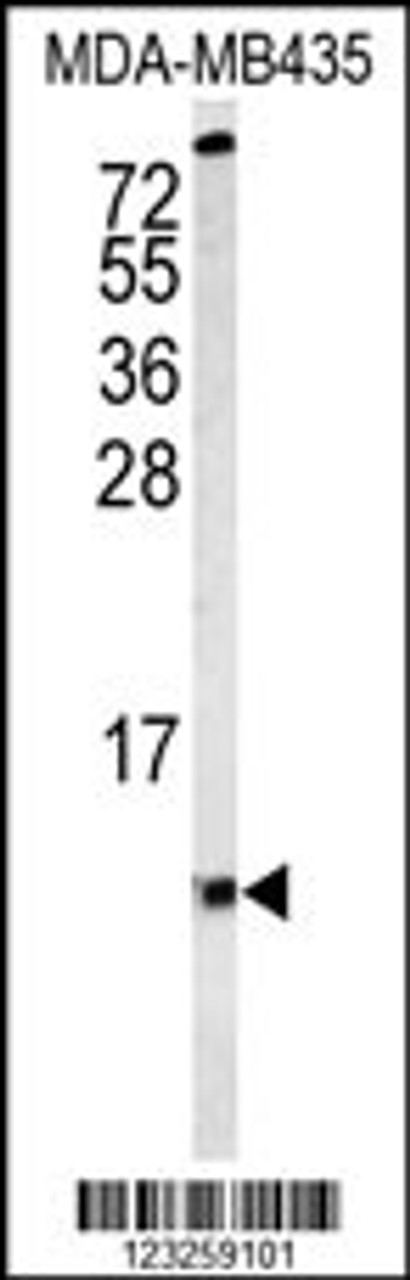 Western blot analysis of COX6A1 Antibody in MDA-MB435 cell line lysates (35ug/lane)