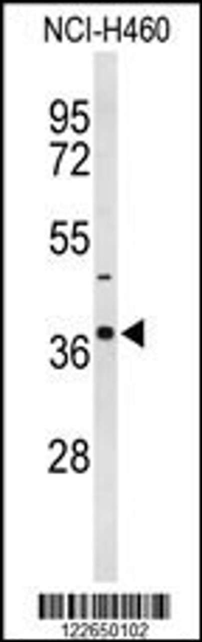 Western blot analysis of SLC25A17 Antibody in NCI-H460 cell line lysates (35ug/lane)