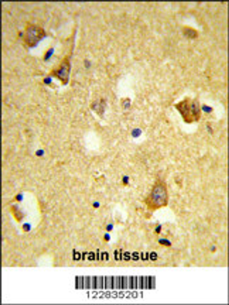 Formalin-fixed and paraffin-embedded human brain tissue reacted with APOBEC3F Antibody (N-term) , which was peroxidase-conjugated to the secondary antibody, followed by DAB staining.