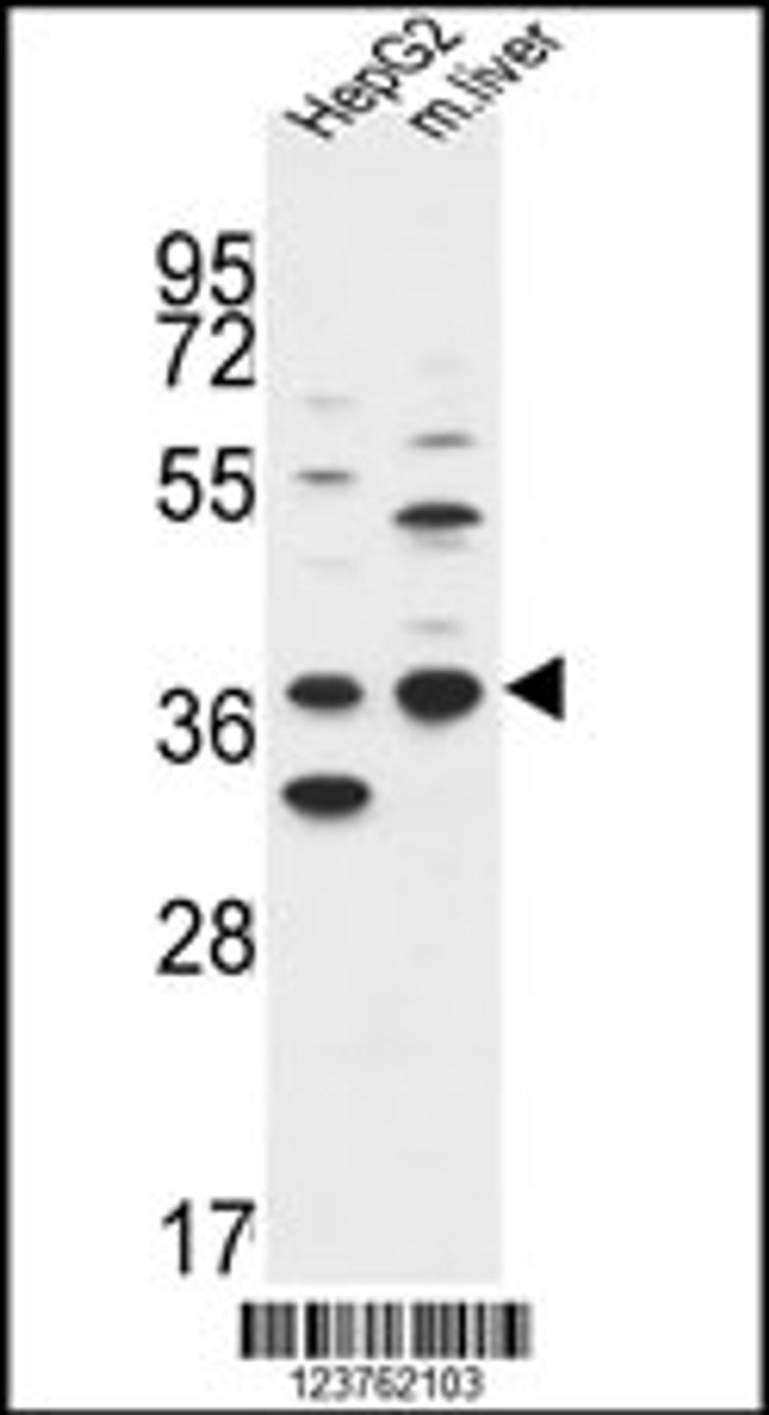 Western blot analysis in HepG2 cell line and mouse liver tissue lysates (35ug/lane) .