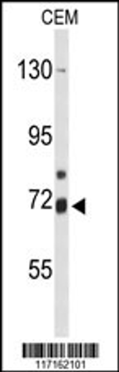 Western blot analysis of ALOX15B Antibody in CEM cell line lysates (35ug/lane)