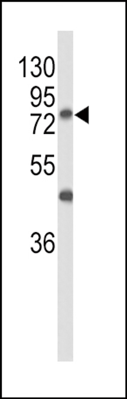 Western blot analysis of GALNT3 Antibody in MCF-7 cell line lysates (35ug/lane)