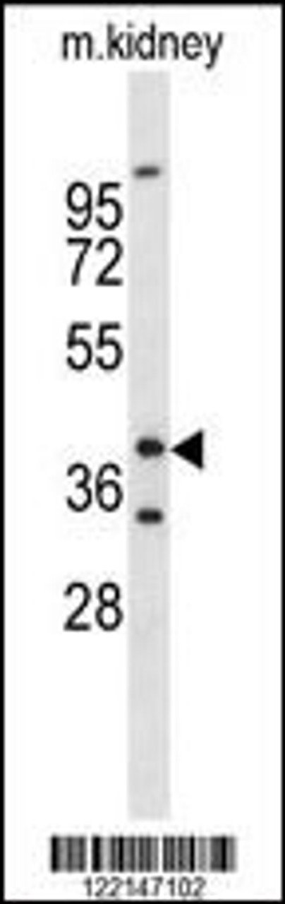 Western blot analysis of FOXL1 Antibody in mouse kidney tissue lysates (35ug/lane)