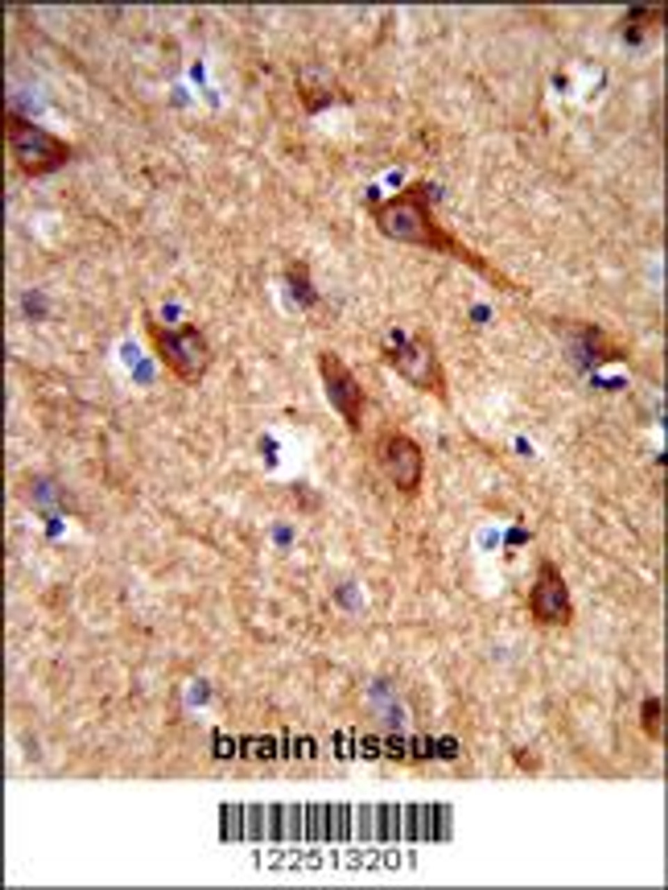 Formalin-fixed and paraffin-embedded human brain tissue reacted with ACCN1 Antibody, which was peroxidase-conjugated to the secondary antibody, followed by DAB staining.