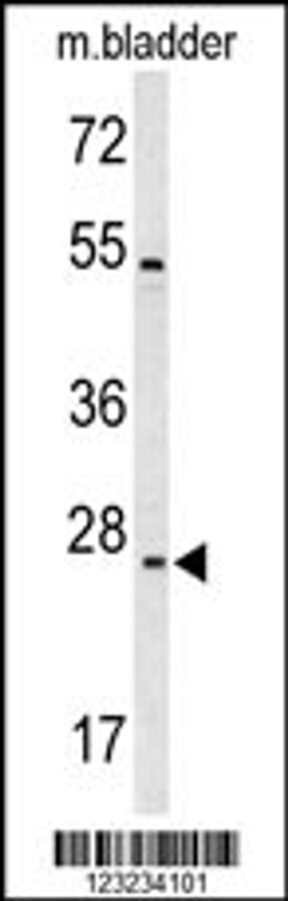 Western blot analysis of TSPAN6 Antibody in mouse bladder tissue lysates (35ug/lane)
