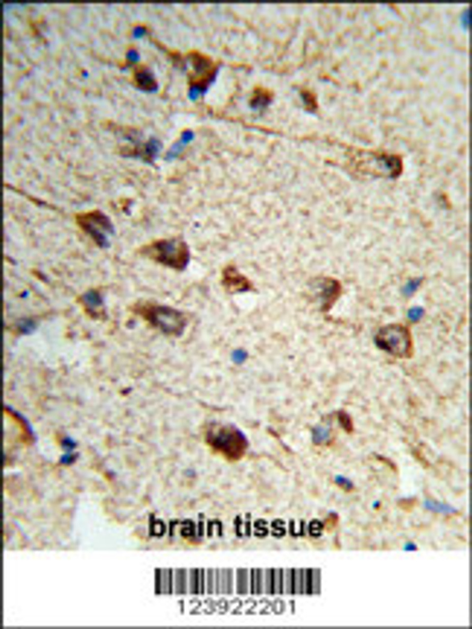 Formalin-fixed and paraffin-embedded human brain tissue reacted with FMOD Antibody, which was peroxidase-conjugated to the secondary antibody, followed by DAB staining.