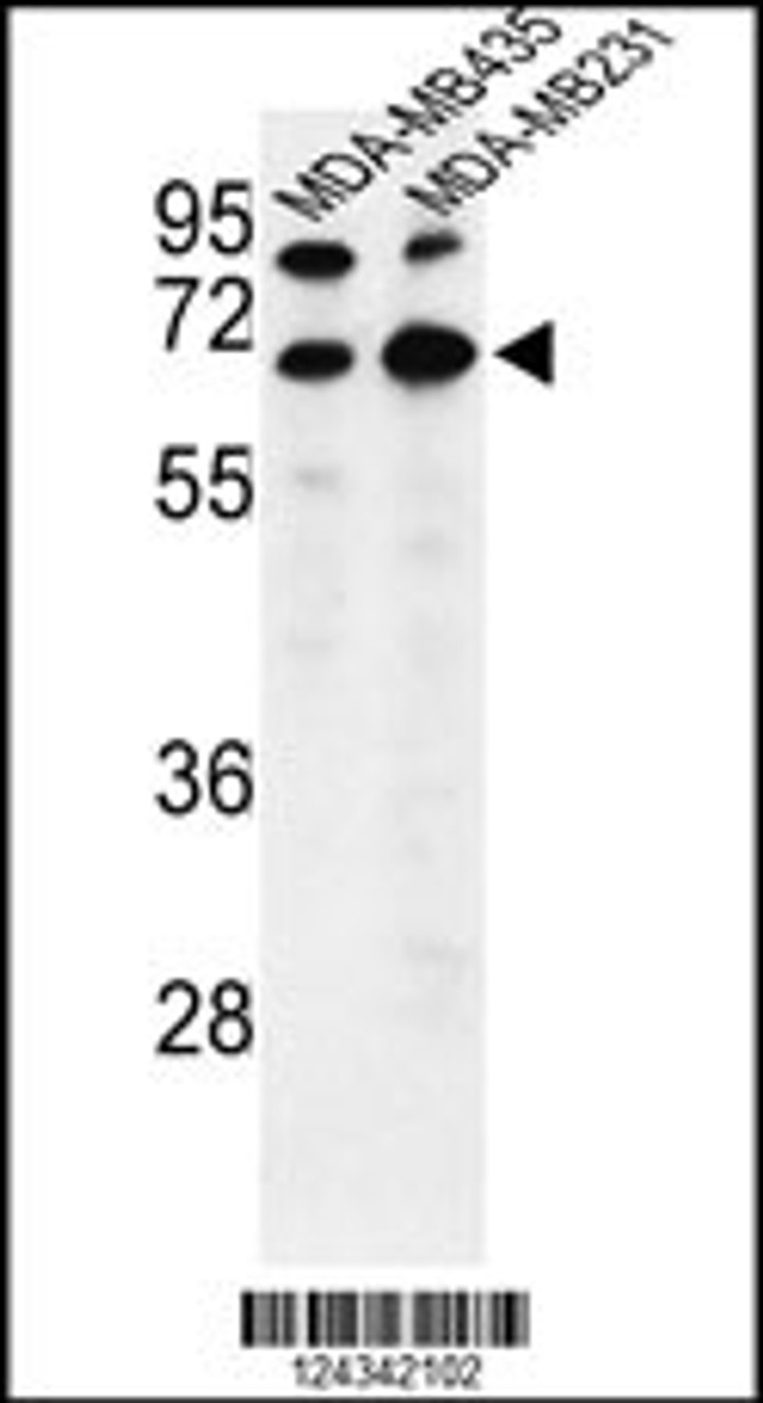 Western blot analysis of BEST2 Antibody in MDA-MB435, MDA-MB231 cell line lysates (35ug/lane)