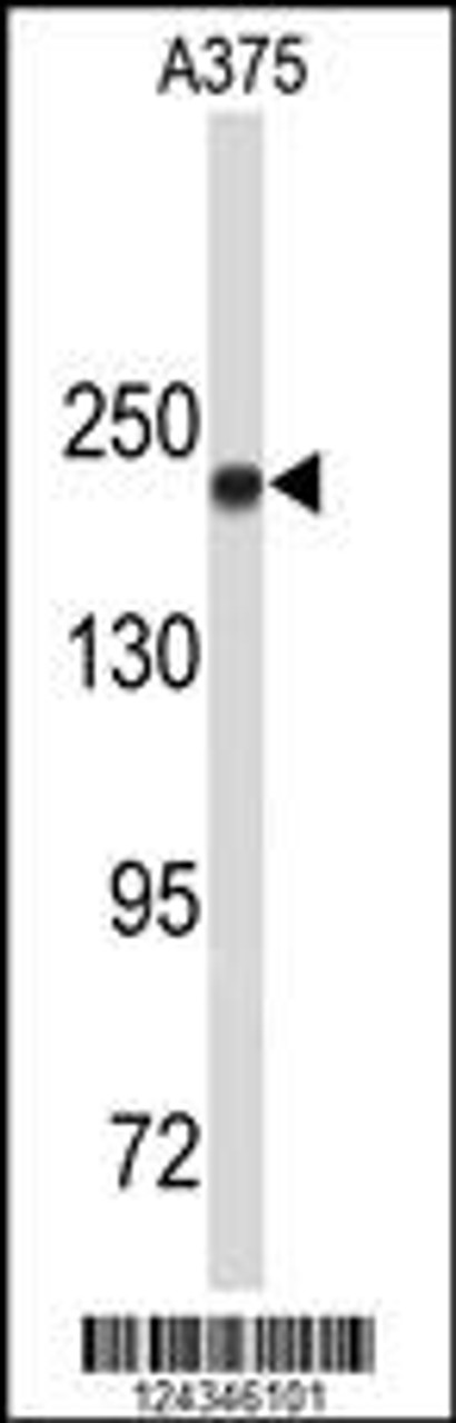 Western blot analysis of TOP2A Antibody in A375 cell line lysates (35ug/lane)