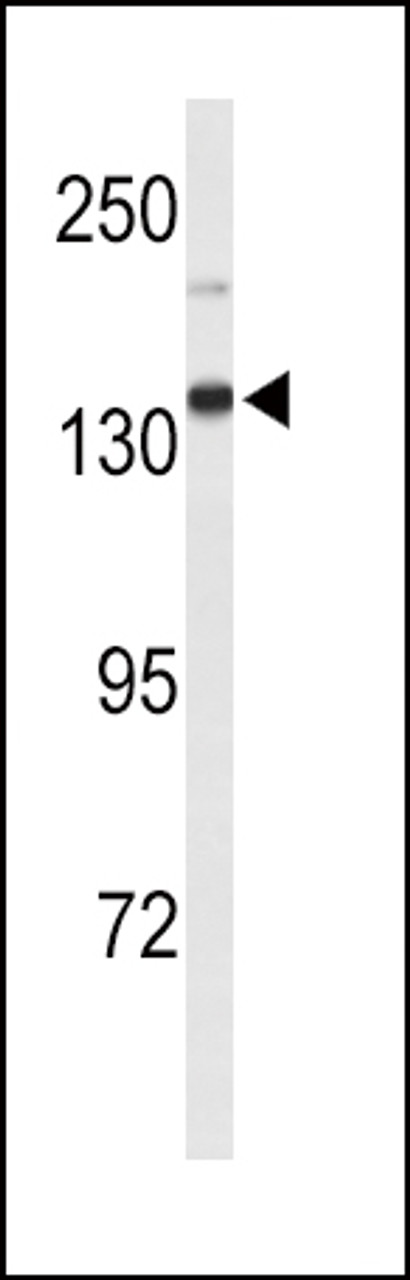 Western blot analysis of XDH Antibody in mouse lung tissue lysates (35ug/lane)