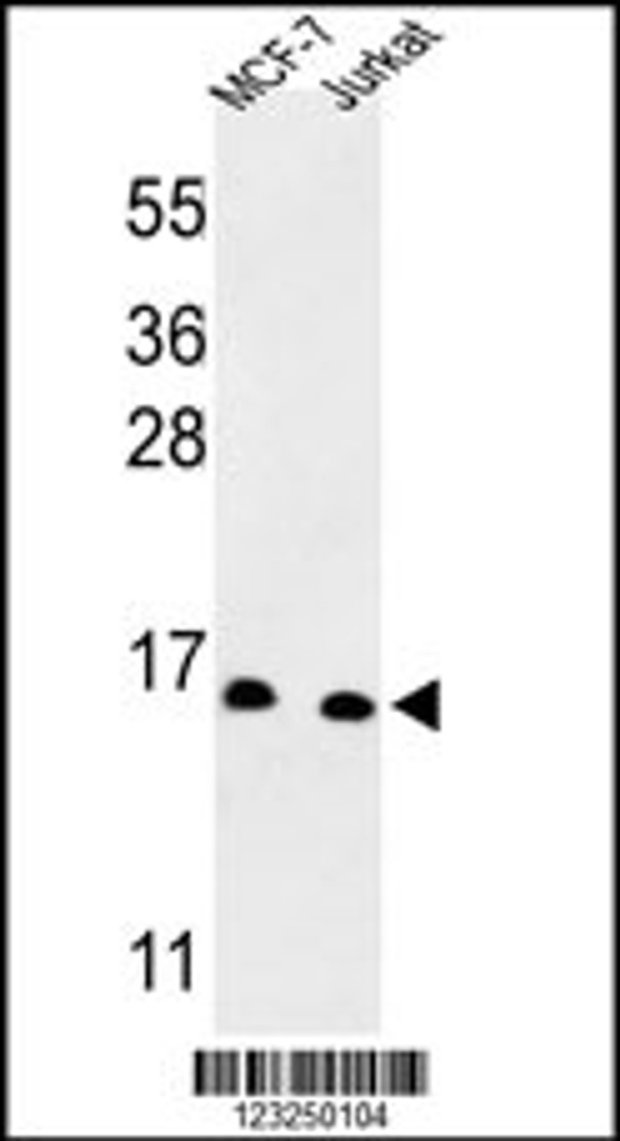 Western blot analysis of SNRPD3 Antibody in MCF-7, Jurkat cell line lysates (35ug/lane)