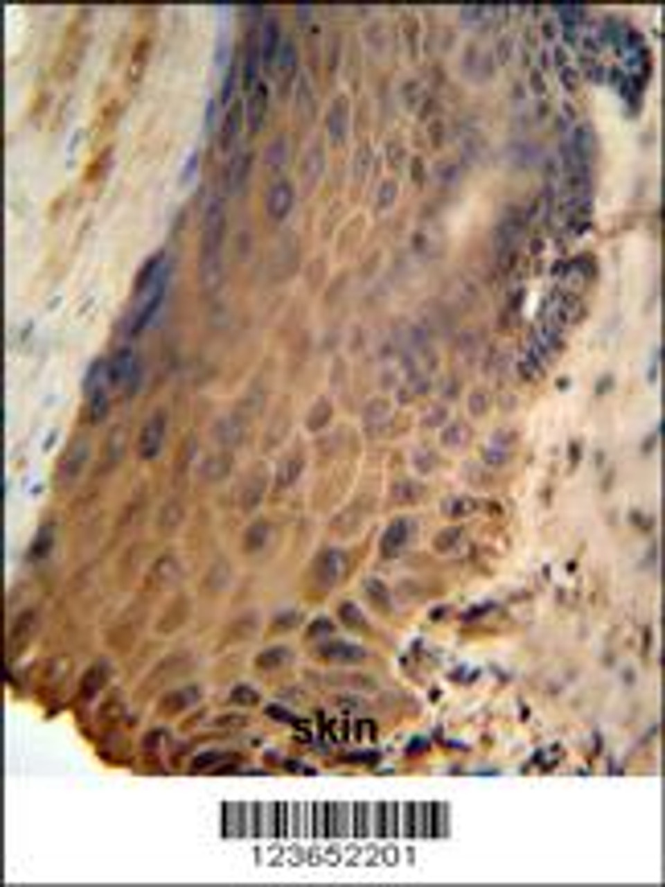 GFPT2 Antibody IHC analysis in formalin fixed and paraffin embedded human skin followed by peroxidase conjugation of the secondary antibody and DAB staining.