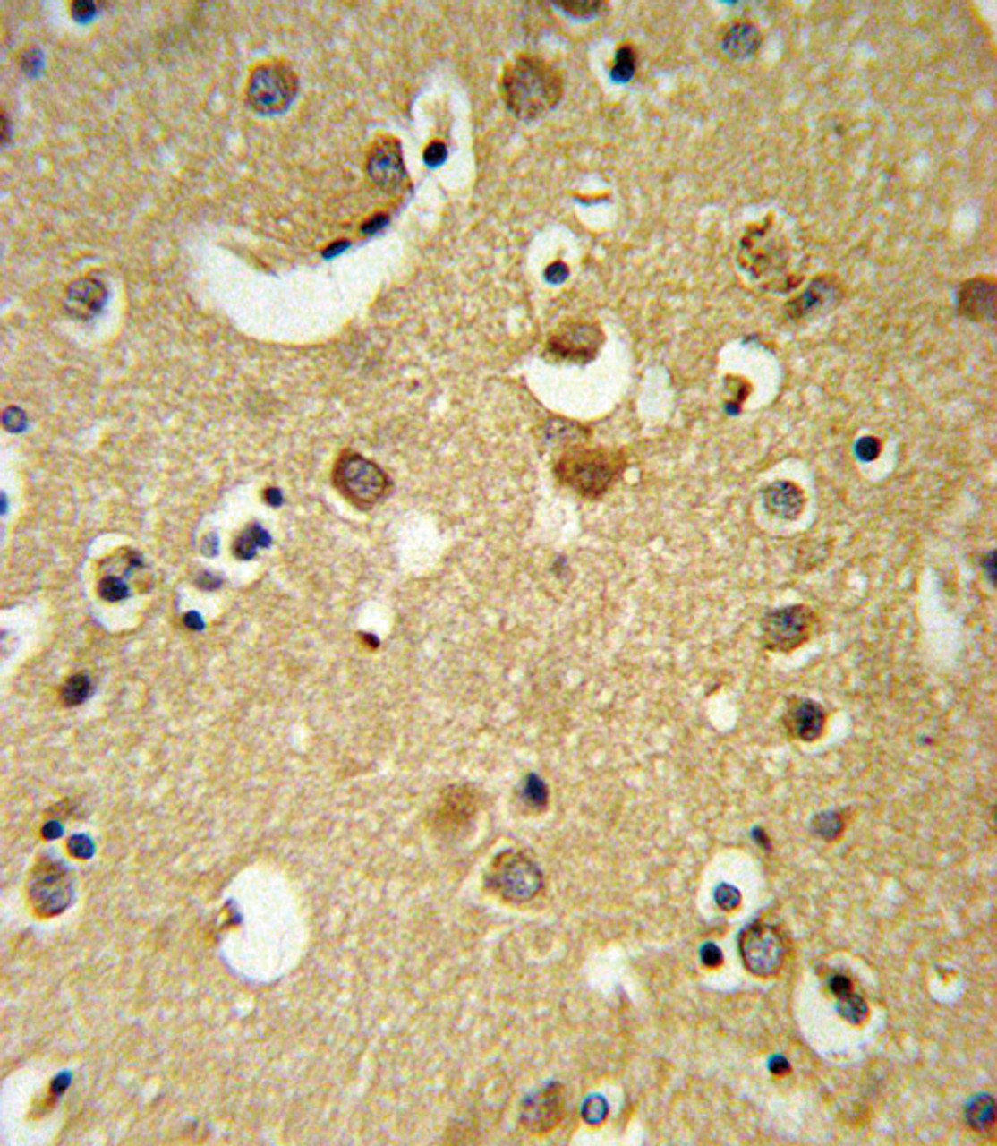 GABRA2 Antibody IHC analysis in formalin fixed and paraffin embedded brain tissue followed by peroxidase conjugation of the secondary antibody and DAB staining.