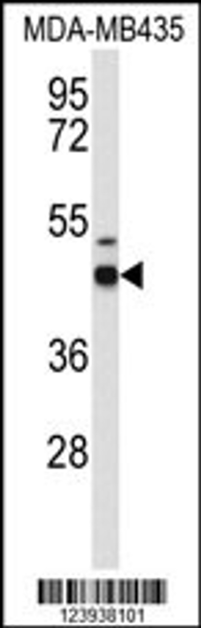 Western blot analysis of GABRD Antibody in MDA-MB435 cell line lysates (35ug/lane)