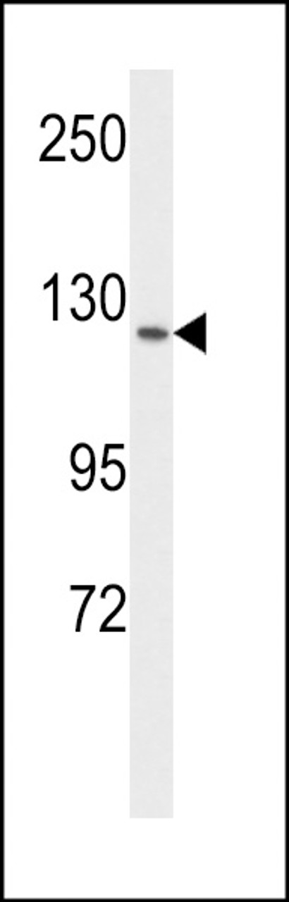 Western blot analysis of VGFR1 Antibody in MCF-7 cell line lysates (35ug/lane)