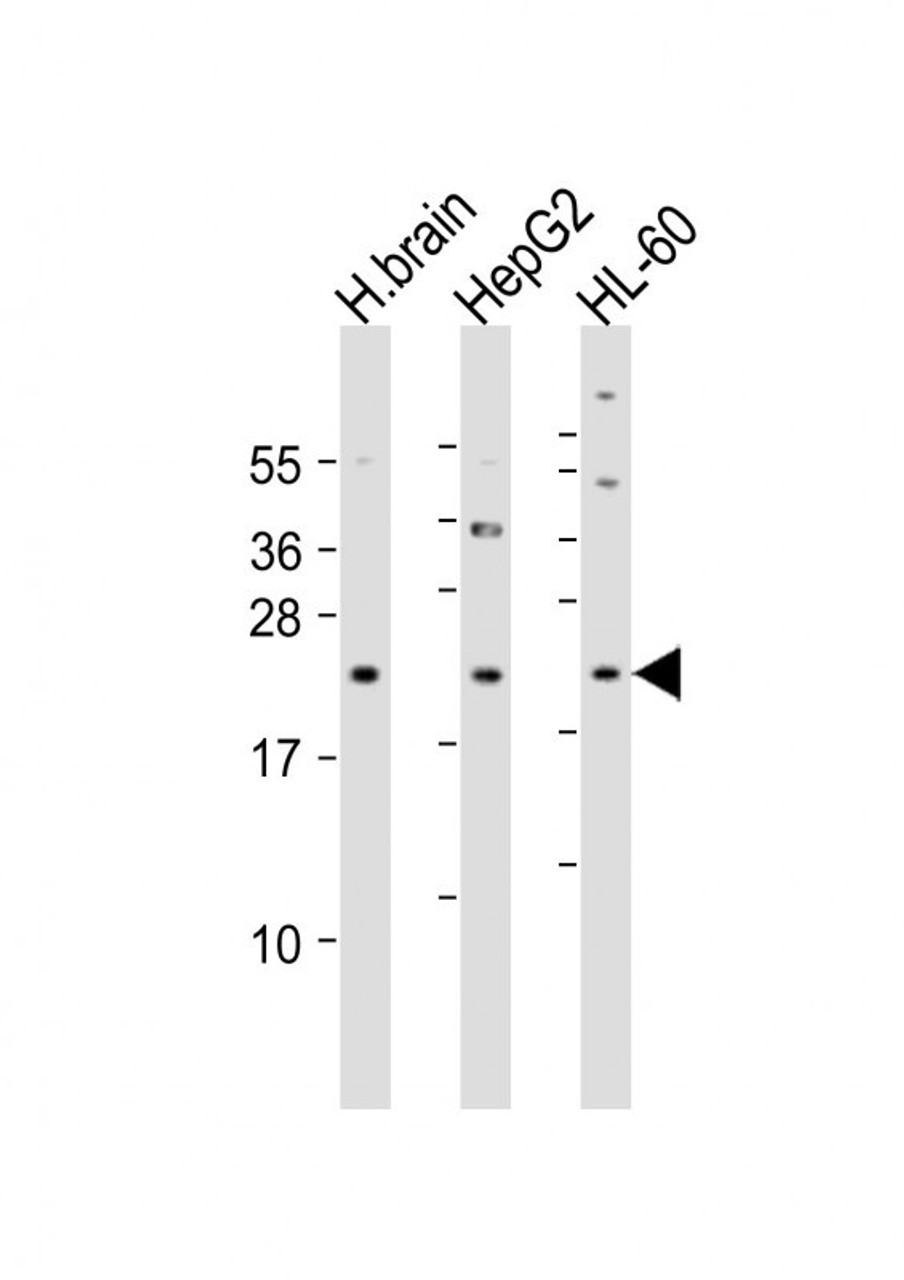 Western Blot at 1:4000 dilution Lane 1: human brain lysate Lane 2: HepG2 whole cell lysate Lane 3: HL-60 whole cell lysate Lysates/proteins at 20 ug per lane.