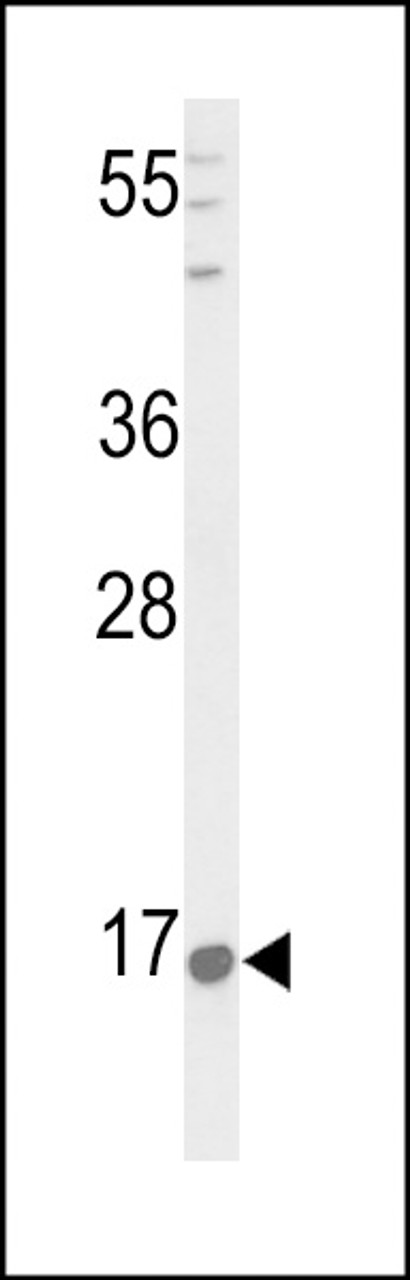 Western blot analysis of PNOC Antibody in HepG2 cell line lysates (35ug/lane)