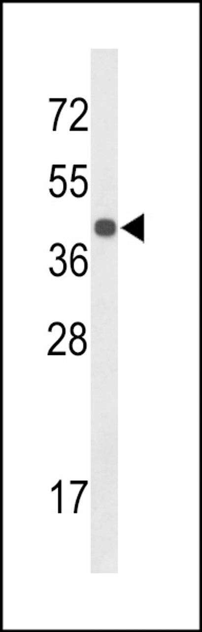 Western blot analysis of CENPK Antibody in mouse liver tissue lysates (35ug/lane)