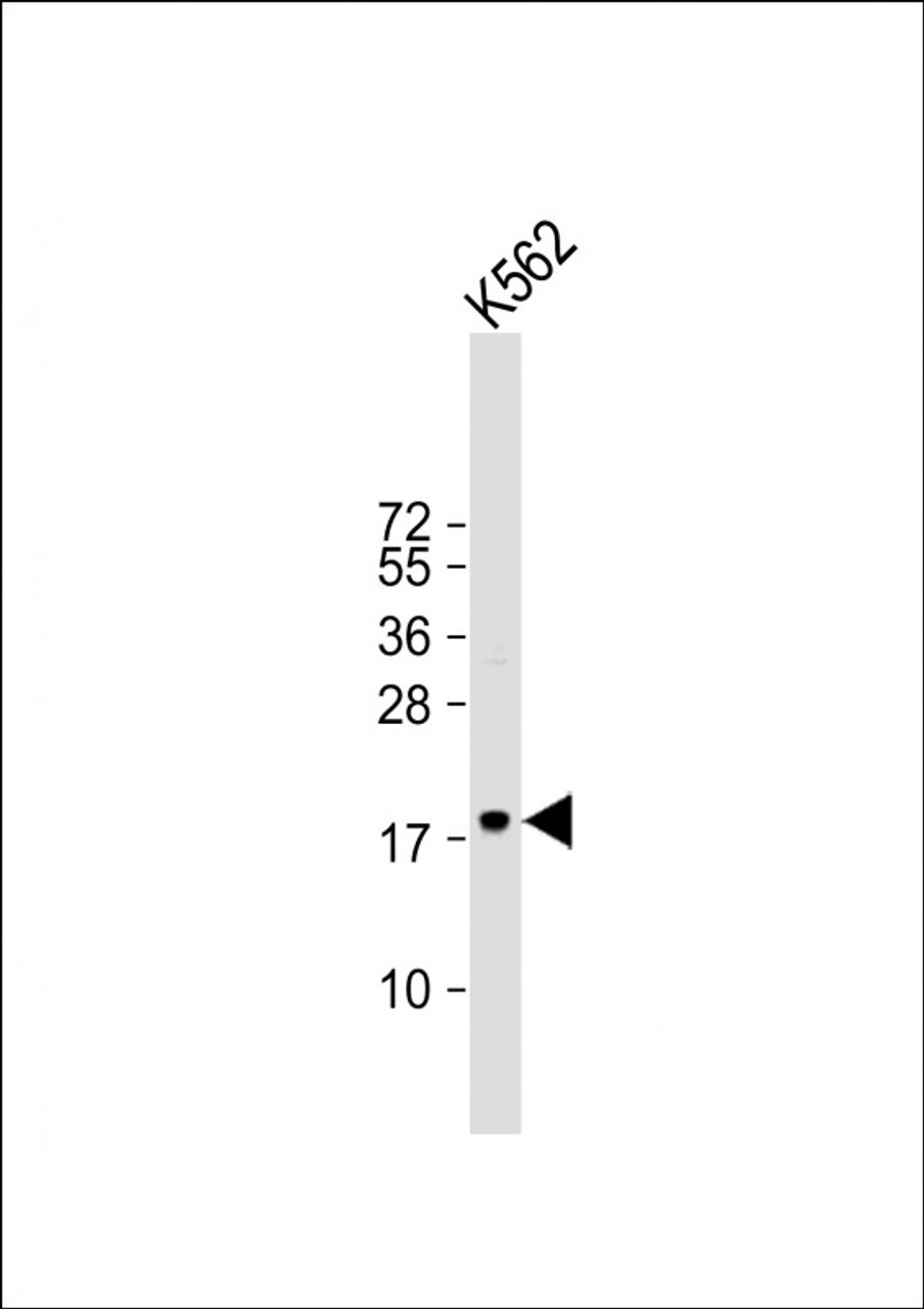 Western Blot at 1:1000 dilution + K562 whole cell lysate Lysates/proteins at 20 ug per lane.