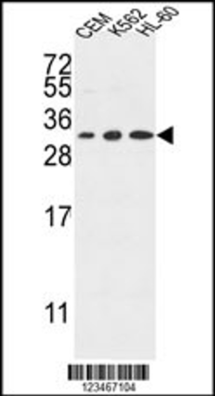 Western blot analysis in CEM, K562, HL-60 cell line lysates (35ug/lane) .