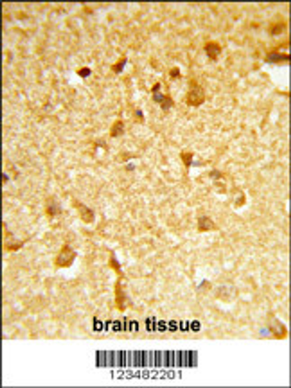Formalin-fixed and paraffin-embedded human brain tissue reacted with DDX17 Antibody (N-term) , which was peroxidase-conjugated to the secondary antibody, followed by DAB staining.