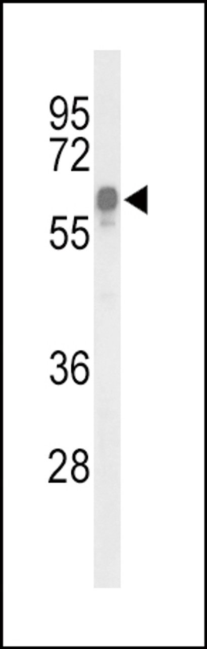 Western blot analysis of ITPKC Antibody in HepG2 cell line lysates (35ug/lane)