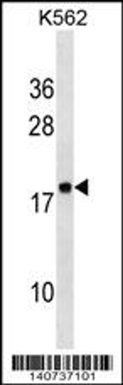 Western blot analysis in K562 cell line lysates (35ug/lane) .