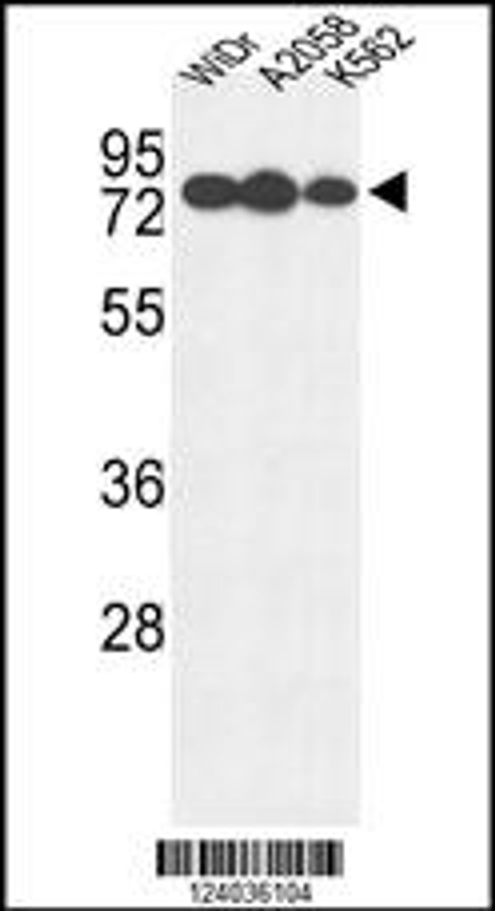 Western blot analysis of GUSB Antibody in WiDr, A2058, K562 cell line lysates (35ug/lane)