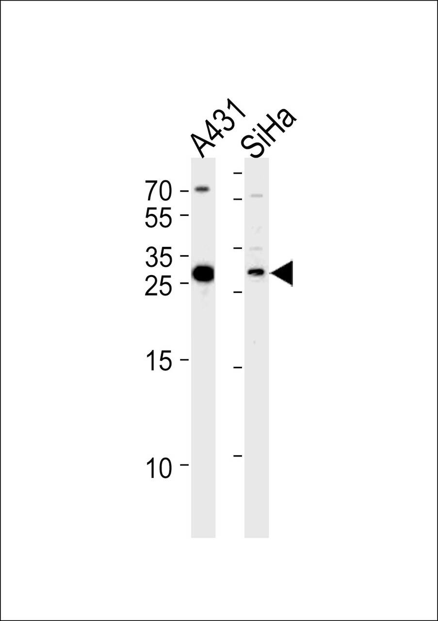 Western blot analysis in A431, SiHa cell line lysates (35ug/lane) .