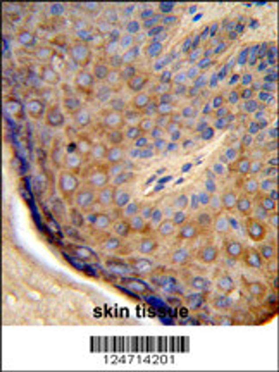 Formalin-fixed and paraffin-embedded human skin tissue reacted with TCHP Antibody, which was peroxidase-conjugated to the secondary antibody, followed by DAB staining.
