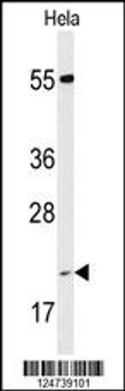 Western blot analysis of PPIC Antibody in Hela cell line lysates (35ug/lane)