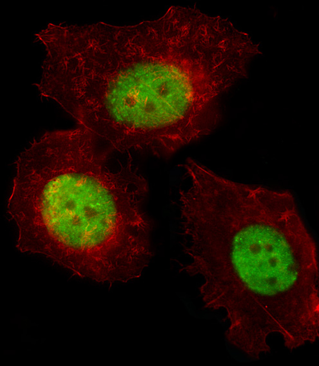 Fluorescent image of MCF-7 cell stained with TREF1 Antibody .MCF-7 cells were fixed with 4% PFA (20 min) , permeabilized with Triton X-100 (0.1%, 10 min) , then incubated with TREF1 primary antibody (1:25) . For secondary antibody, Alexa Fluor 488 conjugated donkey anti-rabbit antibody (green) was used (1:400) .Cytoplasmic actin was counterstained with Alexa Fluor 555 (red) conjugated Phalloidin (7units/ml) .TREF1 immunoreactivity is localized to Nucleus significantly.