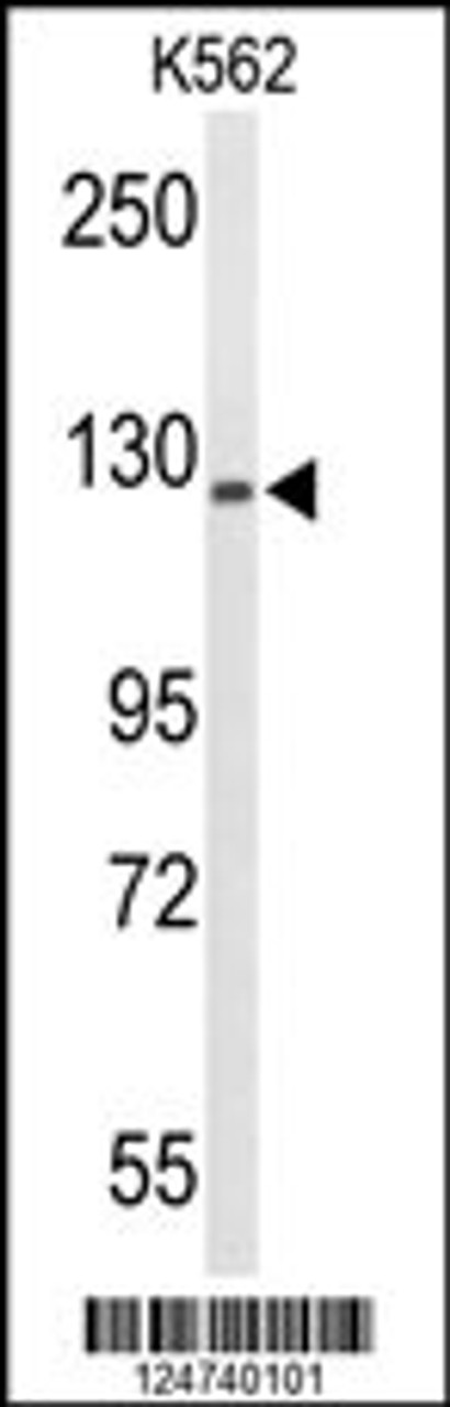 Western blot analysis of TREF1 Antibody in K562 cell line lysates (35ug/lane)