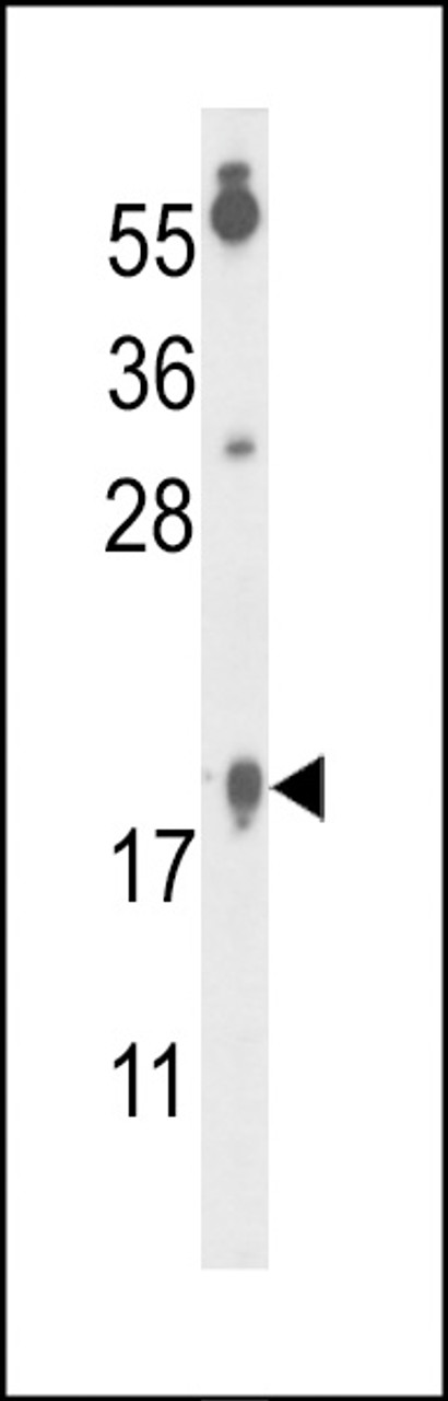 Western blot analysis of FA96B Antibody in A375 cell line lysates (35ug/lane)