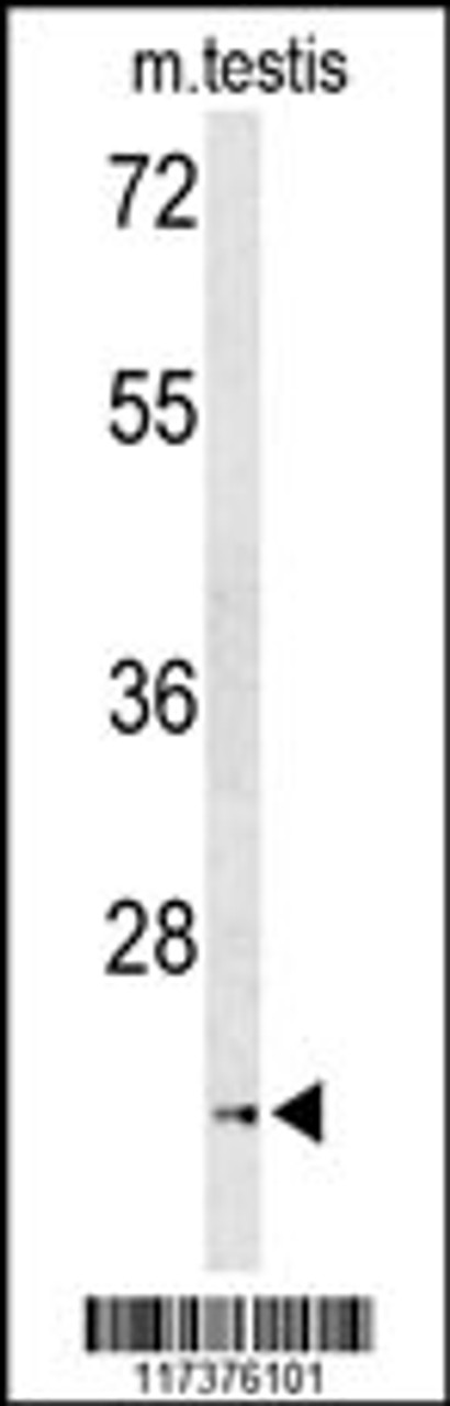 Western blot analysis of UNC119 Antibody in mouse testis tissue lysates (35ug/lane)