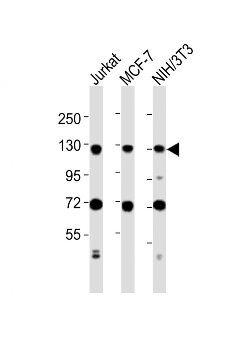 Western Blot at 1:2000 dilution Lane 1: Jurkat whole cell lysates Lane 2: MCF-7 whole cell lysates Lane 3: NIH/3T3 whole cell lysates Lysates/proteins at 20 ug per lane.