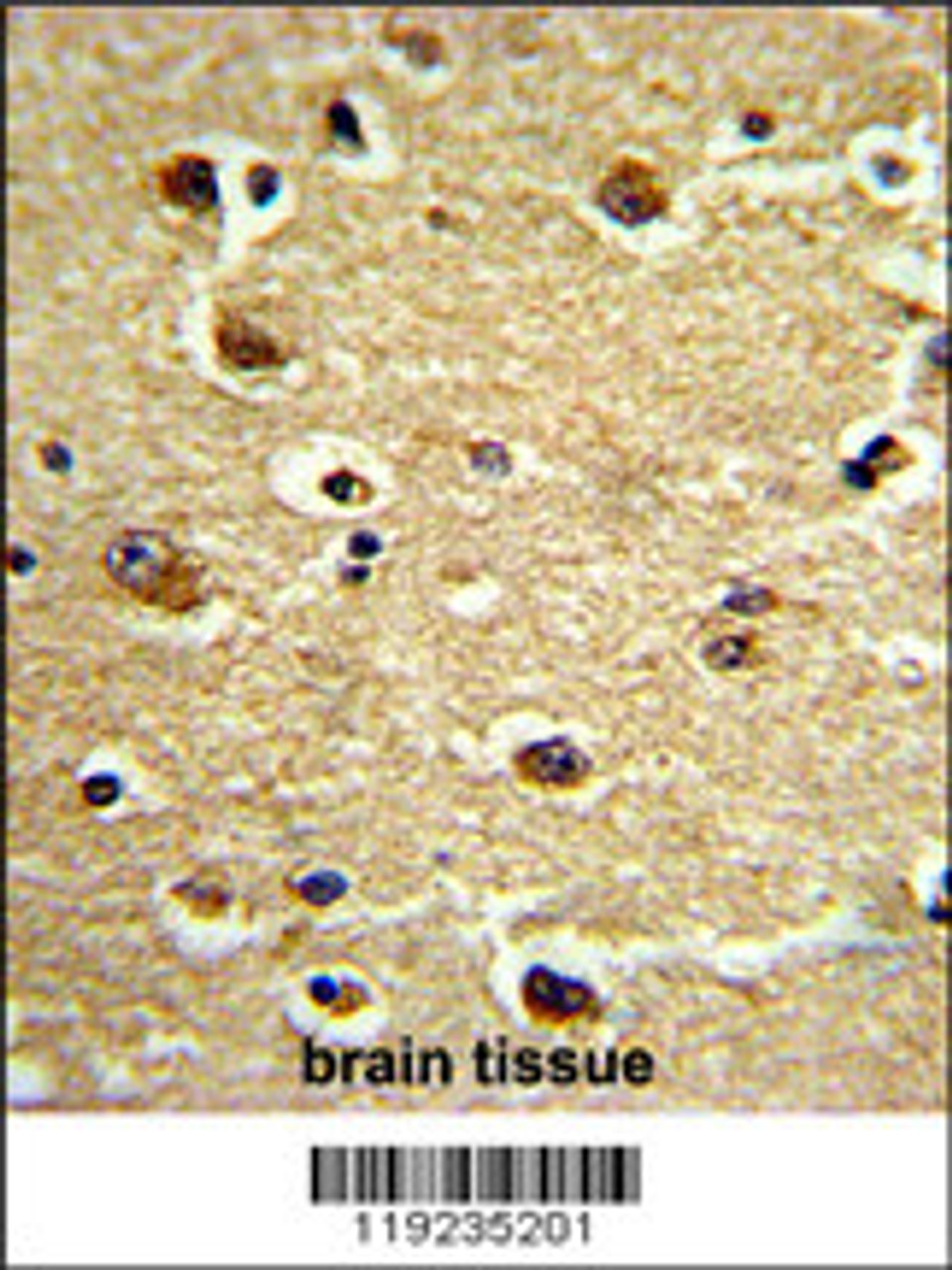 Formalin-fixed and paraffin-embedded human brain tissue reacted with CROT Antibody (N-term) , which was peroxidase-conjugated to the secondary antibody, followed by DAB staining.