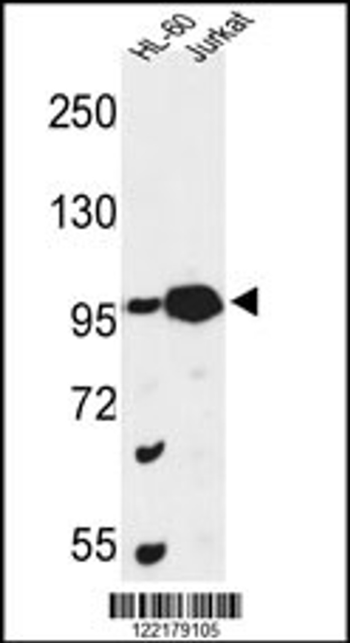 Western blot analysis of CSPP1 Antibody in HL-60, Jurkat cell line lysates (35ug/lane)