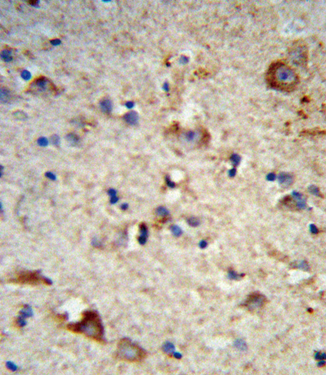 Formalin-fixed and paraffin-embedded human brain tissue reacted with EXT2 Antibody, which was peroxidase-conjugated to the secondary antibody, followed by DAB staining.