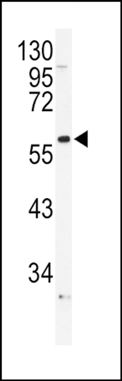 Western blot analysis of ADRA1B Antibody in NCI-H460 cell line lysates (35ug/lane)