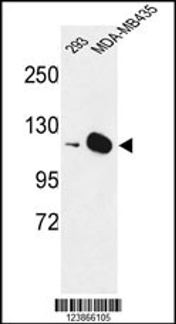 Western blot analysis of DIAPH2 Antibody in 293, MDA-MB435 cell line lysates (35ug/lane)