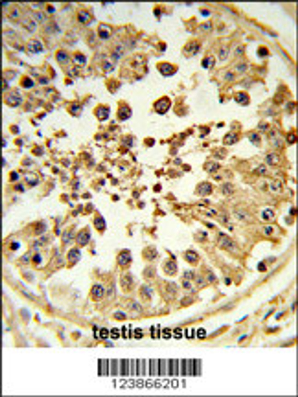 Formalin-fixed and paraffin-embedded human testis tissue reacted with DIAPH2 Antibody, which was peroxidase-conjugated to the secondary antibody, followed by DAB staining.