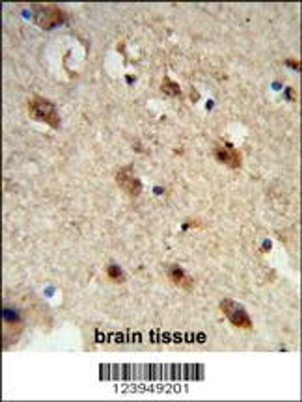 Formalin-fixed and paraffin-embedded human brain tissue reacted with ACP1 Antibody (N-term) , which was peroxidase-conjugated to the secondary antibody, followed by DAB staining.