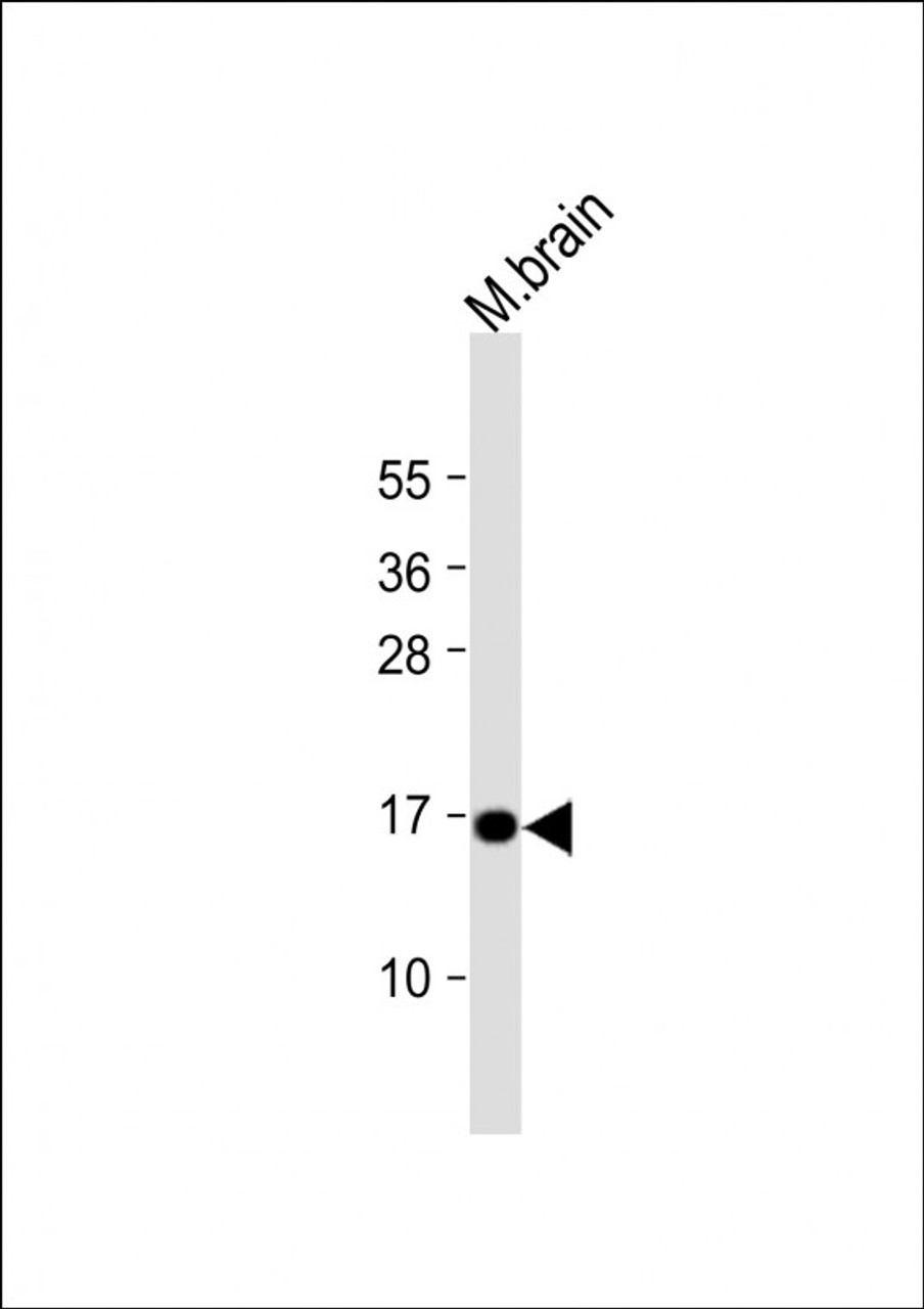 Western Blot at 1:1000 dilution + mouse brain lysate Lysates/proteins at 20 ug per lane.