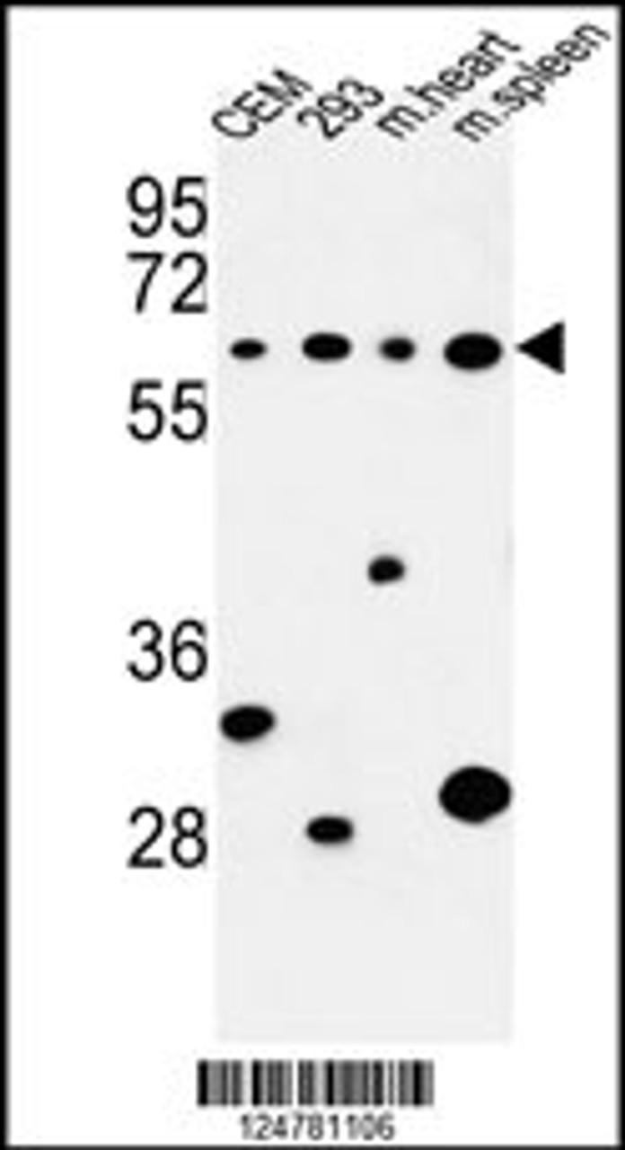 Western blot analysis of PLCZ1 Antibody in CEM, 293 cell line and mouse heart, spleen tissue lysates (35ug/lane)