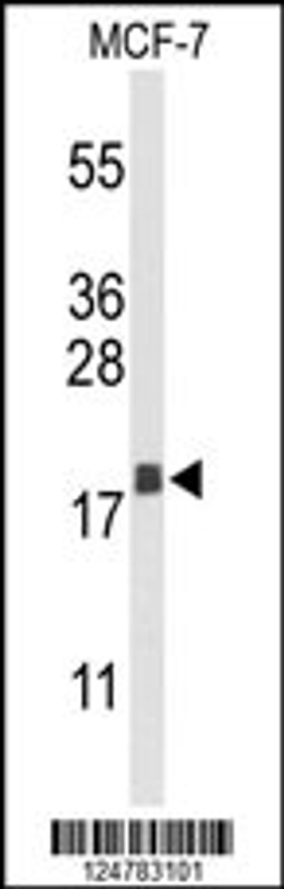Western blot analysis of AGR3 Antibody in MCF-7 cell line lysates (35ug/lane)